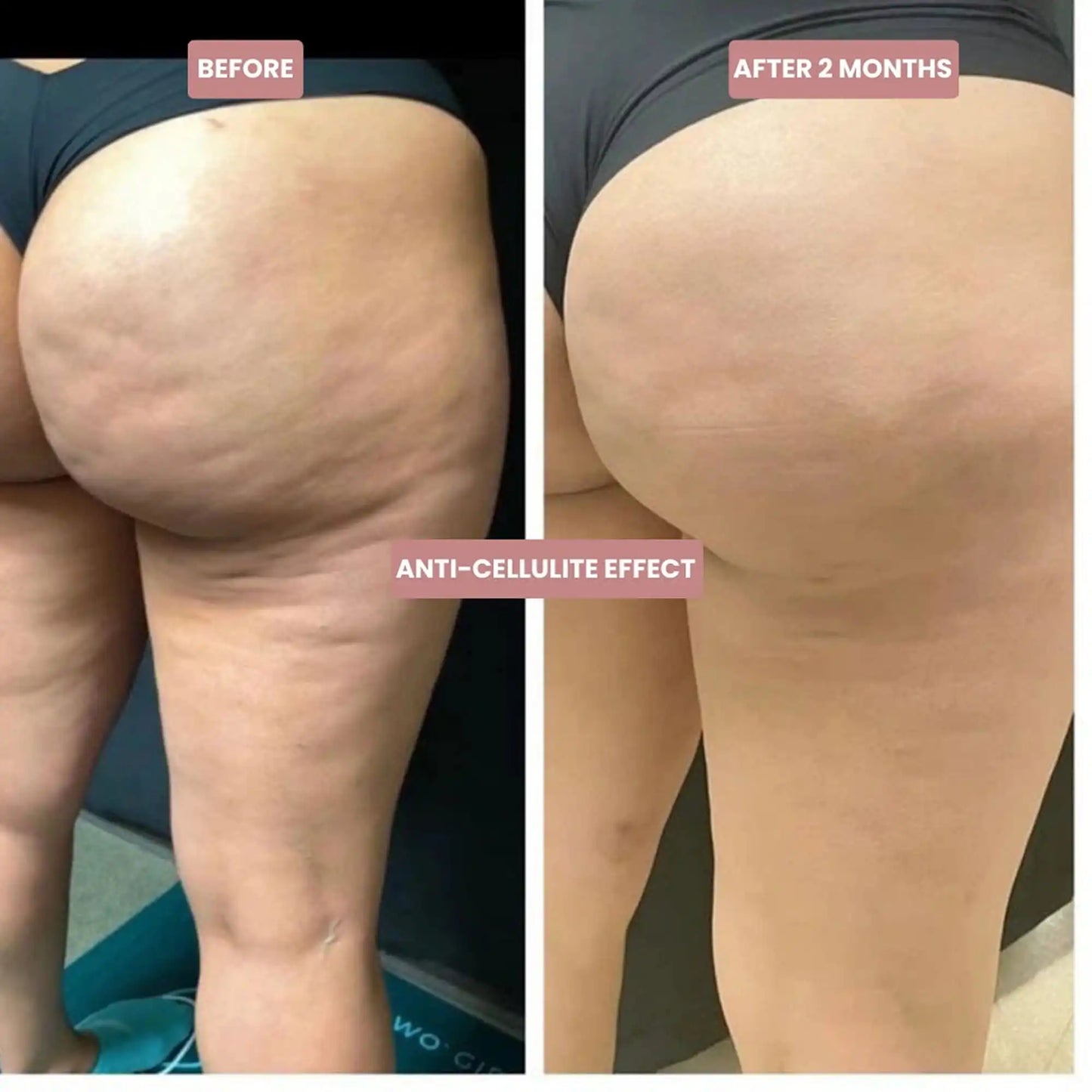 Legging Sculptant Nobella™ — Silhouette Sublimée en 7 Jours ou Remboursée